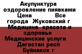 Акупунктура, оздоровление пиявками › Цена ­ 3 000 - Все города, Жуковский г. Медицина, красота и здоровье » Медицинские услуги   . Дагестан респ.,Буйнакск г.